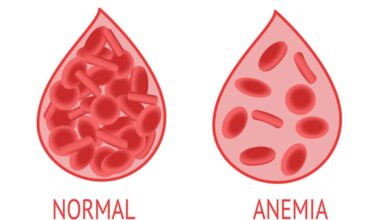 30% Remaja Putri Cirebon Alami Anemia, Kenali Pemicunya!